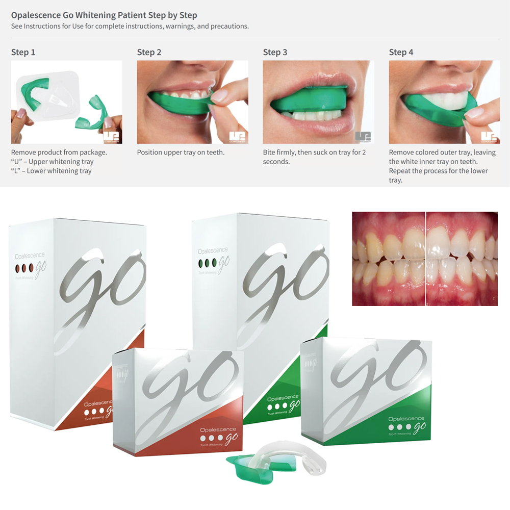 Teeth Whitening Opalescence Go - Opale szenz gehen Zahn aufhellung schalen