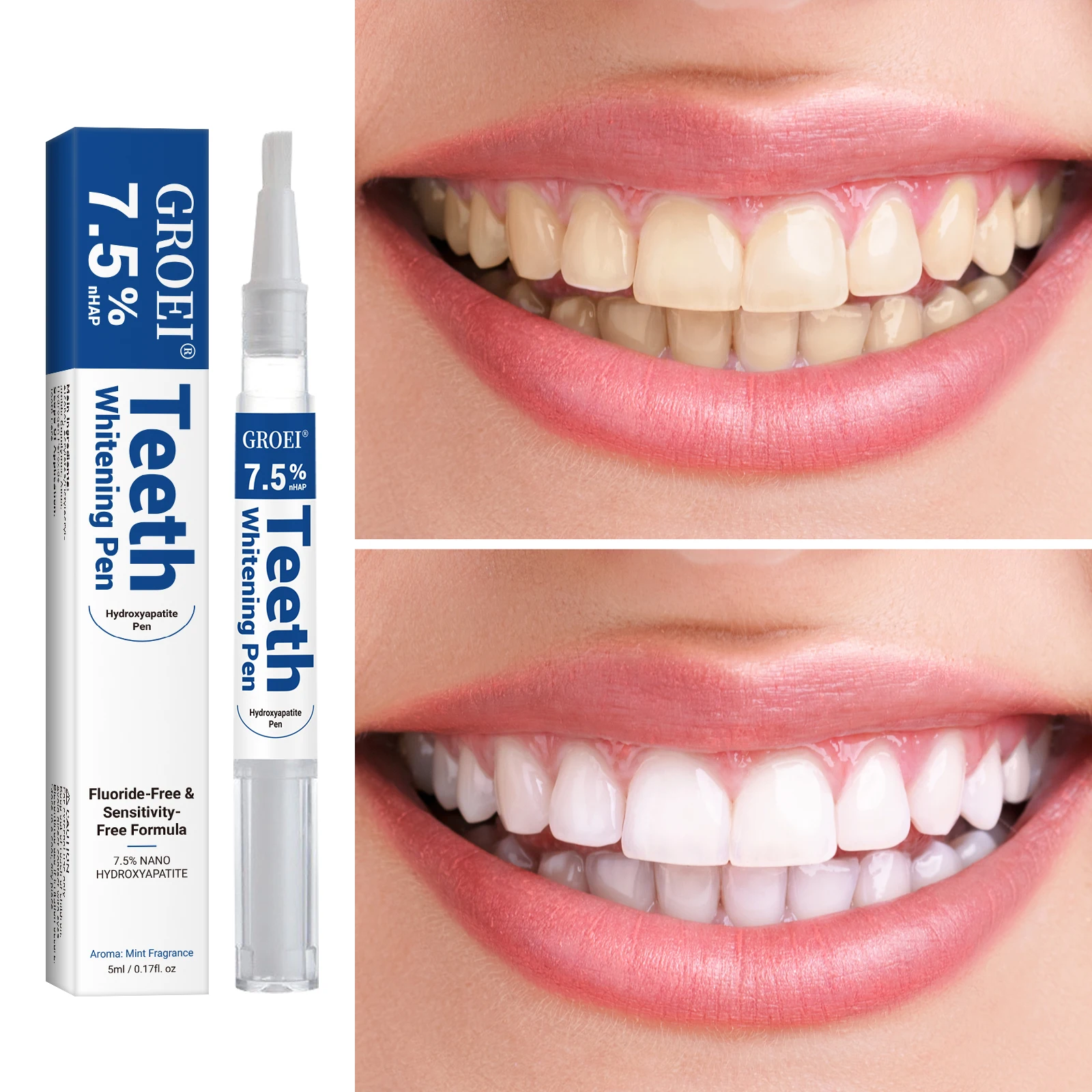Hydroxyapatite Zahnaufhellungs – Teeth Whitening Singapore Bewertung und Preis