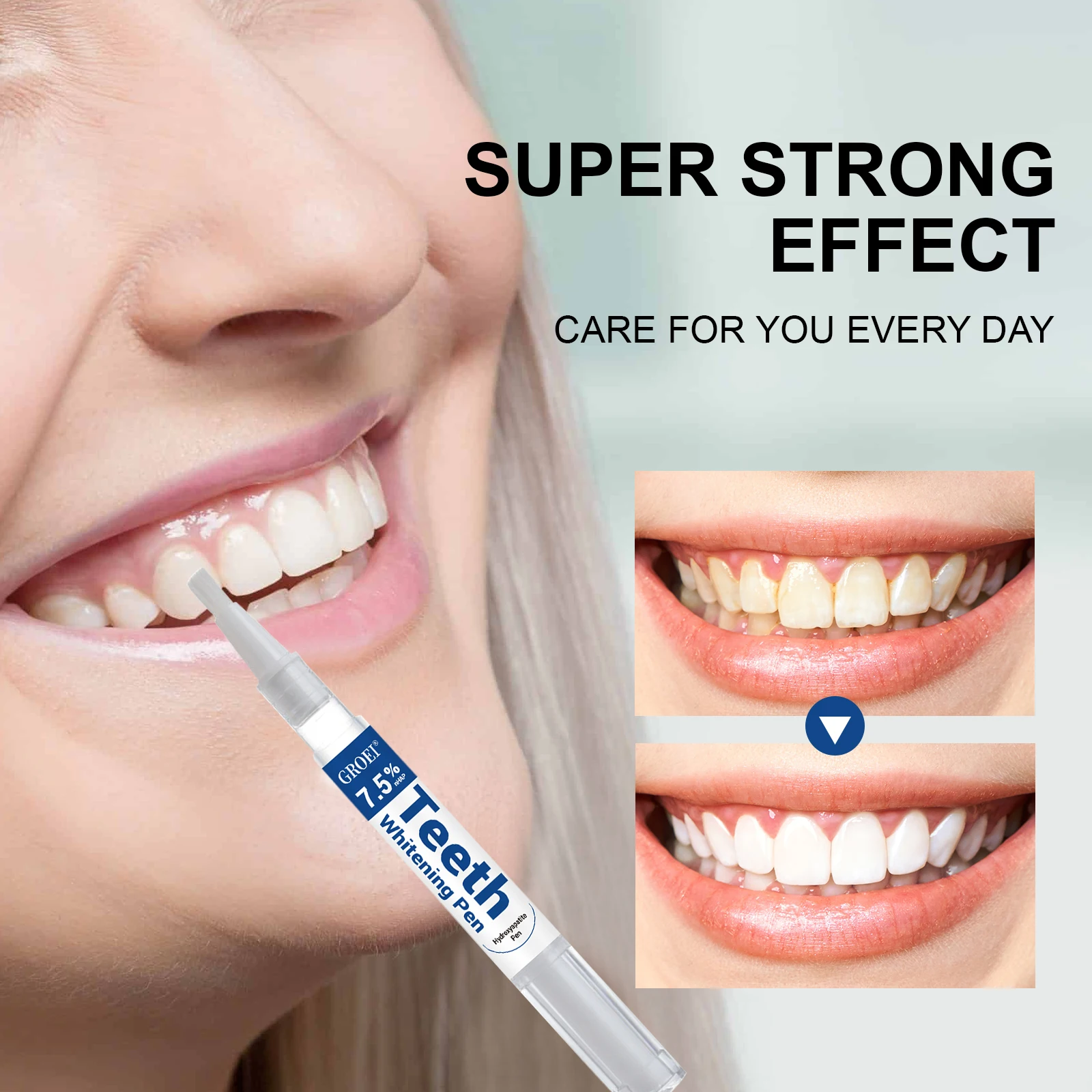 Hydroxyapatite Zahnaufhellungs – Teeth Whitening Singapore Bewertung und Preis