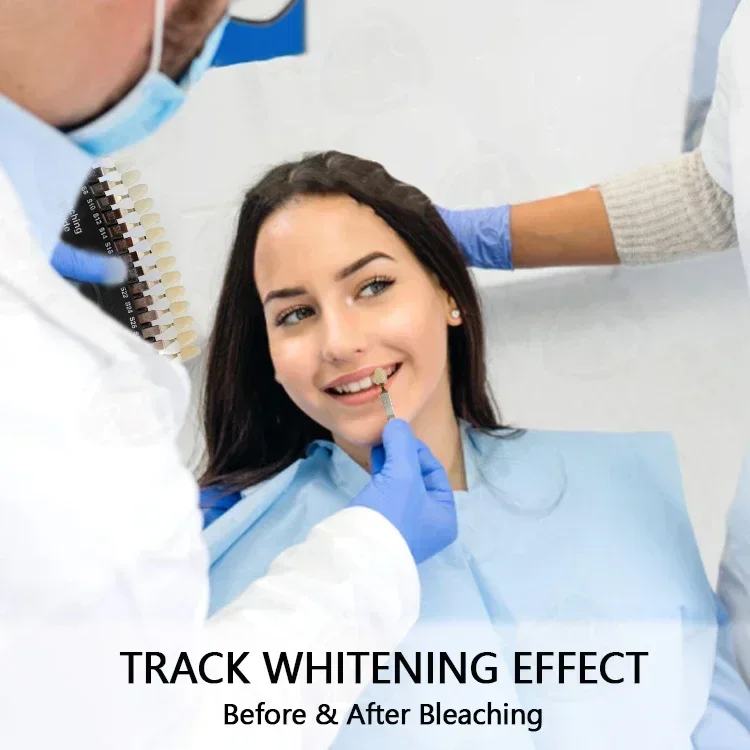 Professionelle Zahnaufhellung, – Teeth Whitening Shade Guide Bewertung und Preis