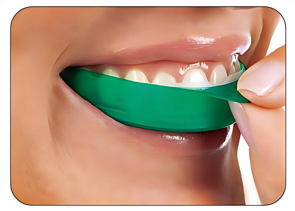 Ultradent Opalescence Go Zahna – Teeth Whitening Opalescence Go Bewertung und Preis