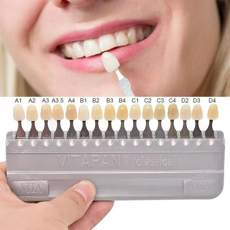 VITA 16-Farben-Zahnschattenfüh – Teeth Whitening Shade Guide Bewertung und Preis