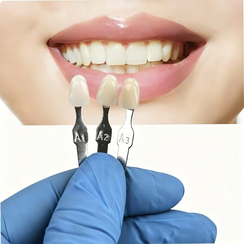 VITA 16-Farben-Zahnschattenfüh – Teeth Whitening Shade Guide Bewertung und Preis