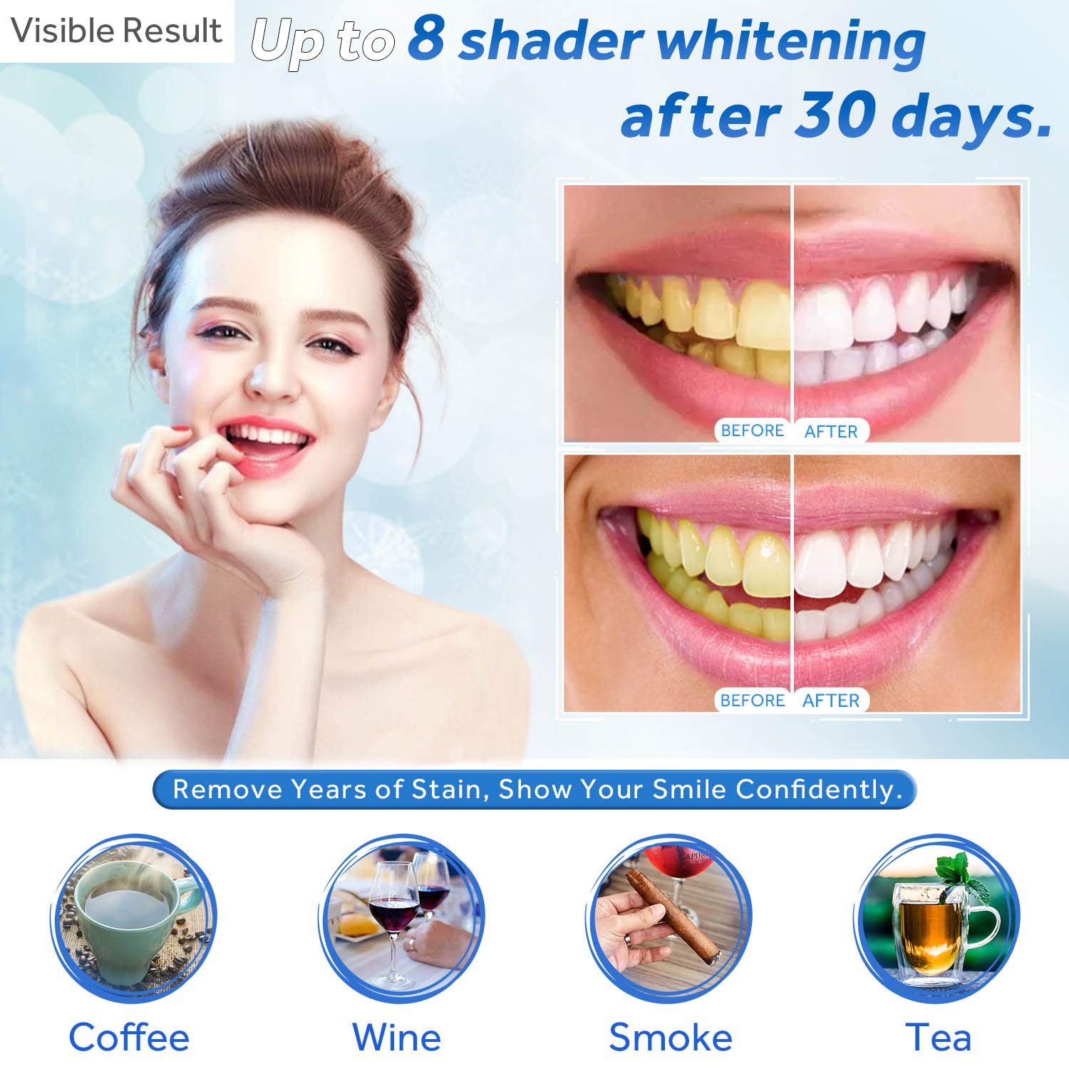 Zahnaufhellungsgel, Nachfüllsp – Colgate Whitening Teeth Bewertung und Preis