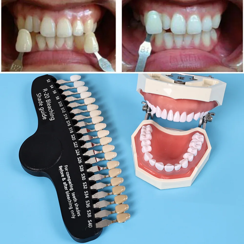 ELIJAH R-20 Bleaching Shade Gu – Teeth Whitening Shade Guide Bewertung und Preis