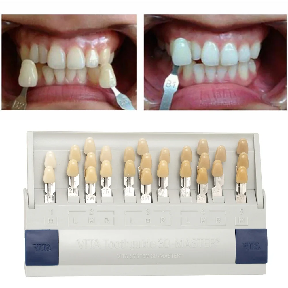 Vita 3D Master Dental Lab Blea – Teeth Whitening Shade Guide Bewertung und Preis